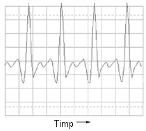 forma de unda ne-sinusoidala afisata pe osciloscop; variatia amplitudine-timp