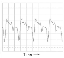 forma de unda ne-sinusoidala afisata pe osciloscop; variatia amplitudine-timp