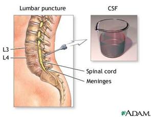 Procedure, part 1