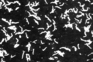 Diagnosticul De Laborator Al Infectiilor Produse De Spirochete