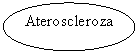 Oval: Ateroscleroza